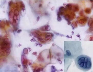 ϴӣךWM(jn)ھϴO(sh)ꑌҼ